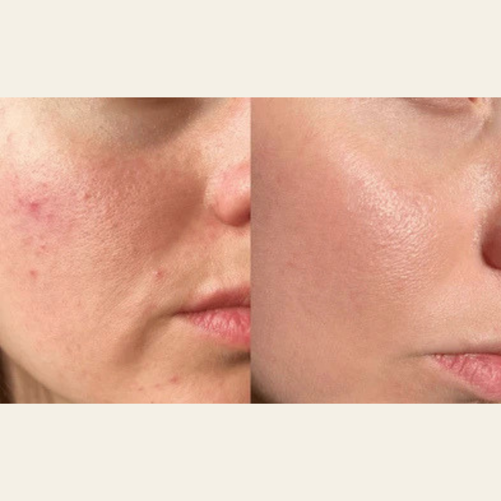 #2 - Daily Liquid Moisturizer