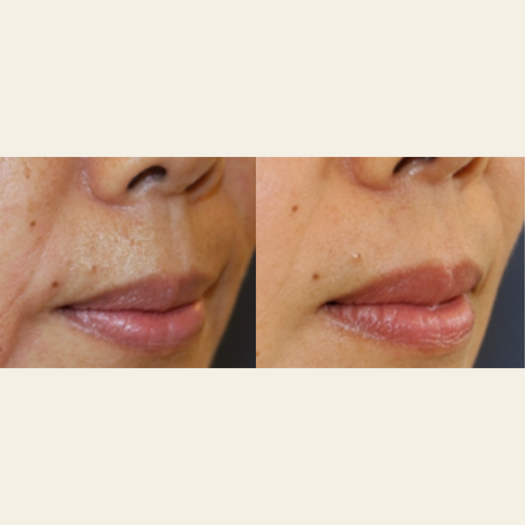 #2 - Daily Liquid Moisturizer