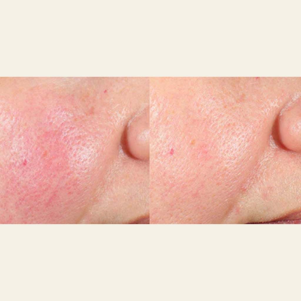 #2 - Daily Liquid Moisturizer